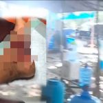 Kembali Mencuat Kelompok Pemuda di Pitu Riase Terluka Usai Dikejar Aparat ,Padahal  Baru Terima Setoran 